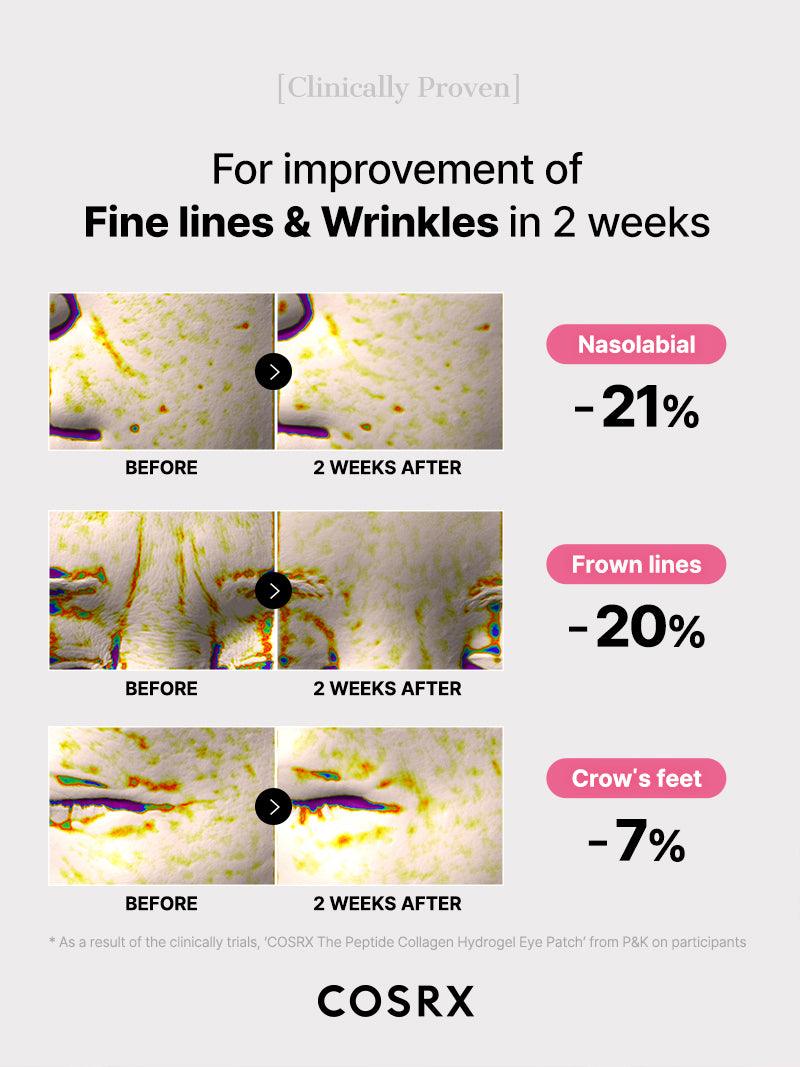 Before-and-after clinical test results of COSRX The Peptide Collagen Hydrogel Eye Patch showing improvement of the appearance of fine lines and wrinkles in two weeks; reductions of 21% in nasolabial folds, 20% in frown lines, and 7% in crow’s feet verified clinical trial by P&K laboratory analysis.