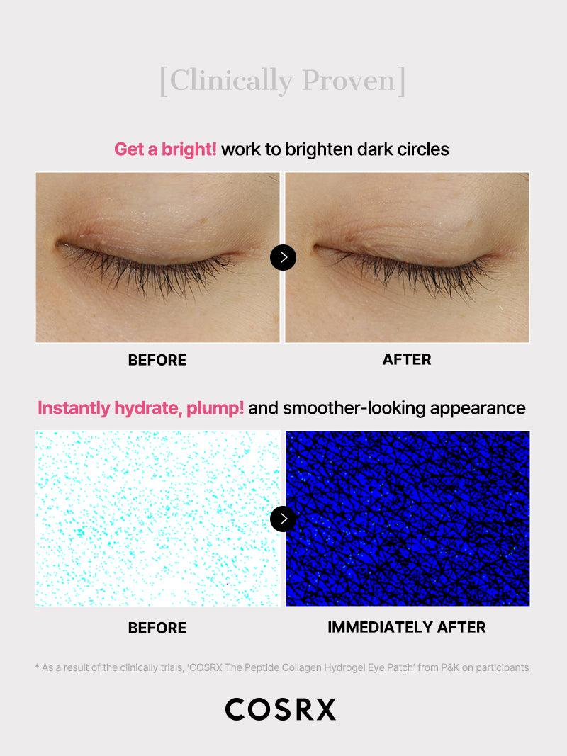 Clinical before-and-after images showing COSRX The Peptide Collagen Hydrogel Eye Patch visibly brightening dark circles and instantly hydrating under-eye skin; microscope results reveal improved plumpness and smooth texture immediately after application, proven in P&K clinical trial.